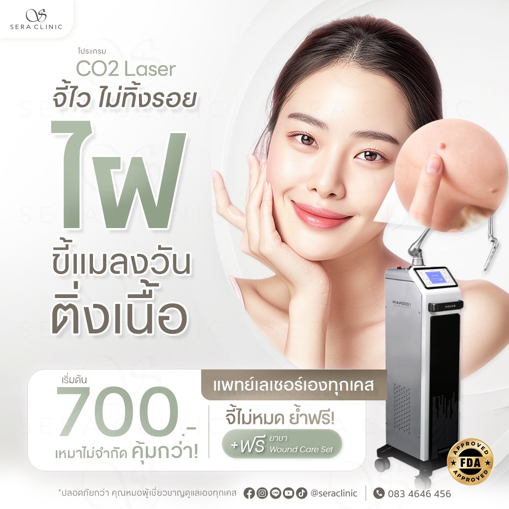 co2 laser กำจัดไฝ ขี้แมลงวัน ติ่งเนื้อ สิวหิน เซราคลินิก sera clinic