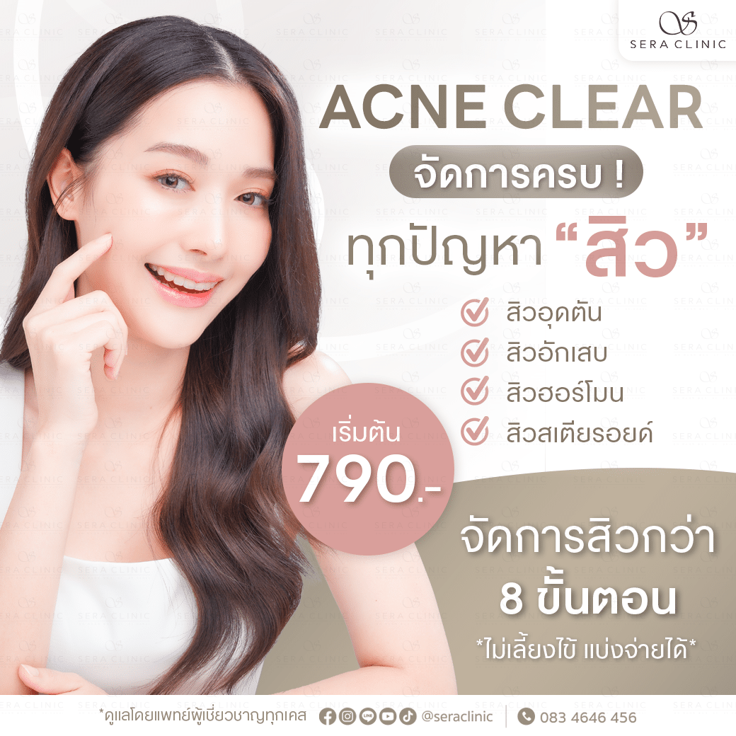Acne Clear 痘痘治疗 消得快 不留印