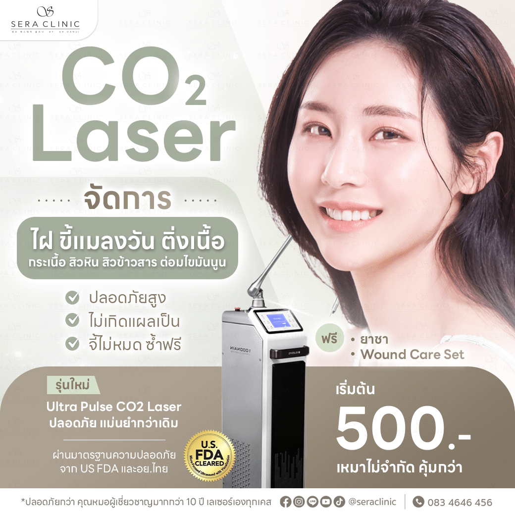 co2 laser กำจัดไฝ ขี้แมลงวัน ติ่งเนื้อ สิวหิน เซราคลินิก sera clinic