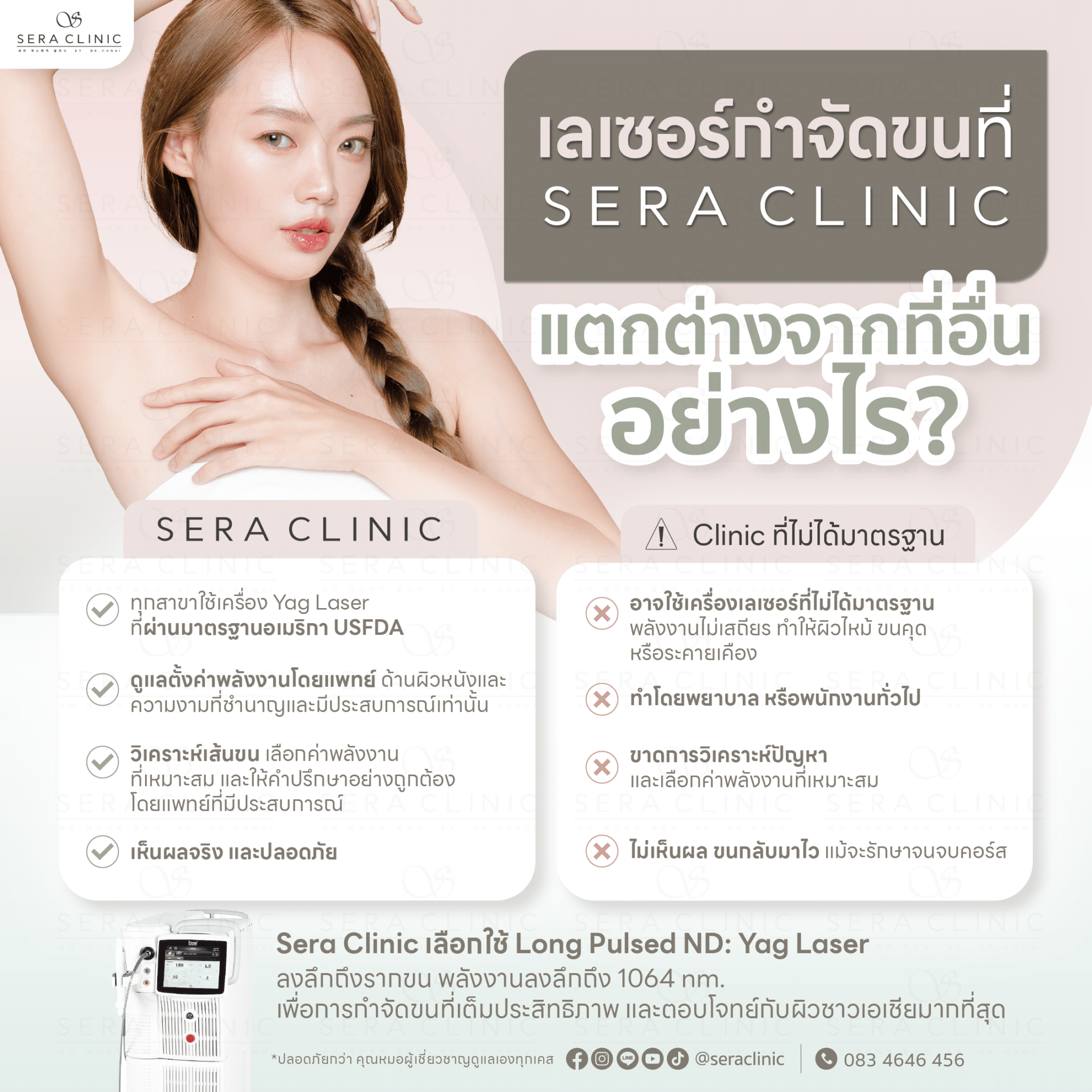 เลเซอร์ กำจัดขนถาวร เลเซอร์ขน ขนรักแร้ ขนบิกินี่ ขนบราซิเลี่ยน long pulsed nd yag laser เซราคลินิก sera clinic เครื่องไม่ได้มาตรฐาน แตกต่างจากที่อื่น คลินิกอื่น อย่างไร