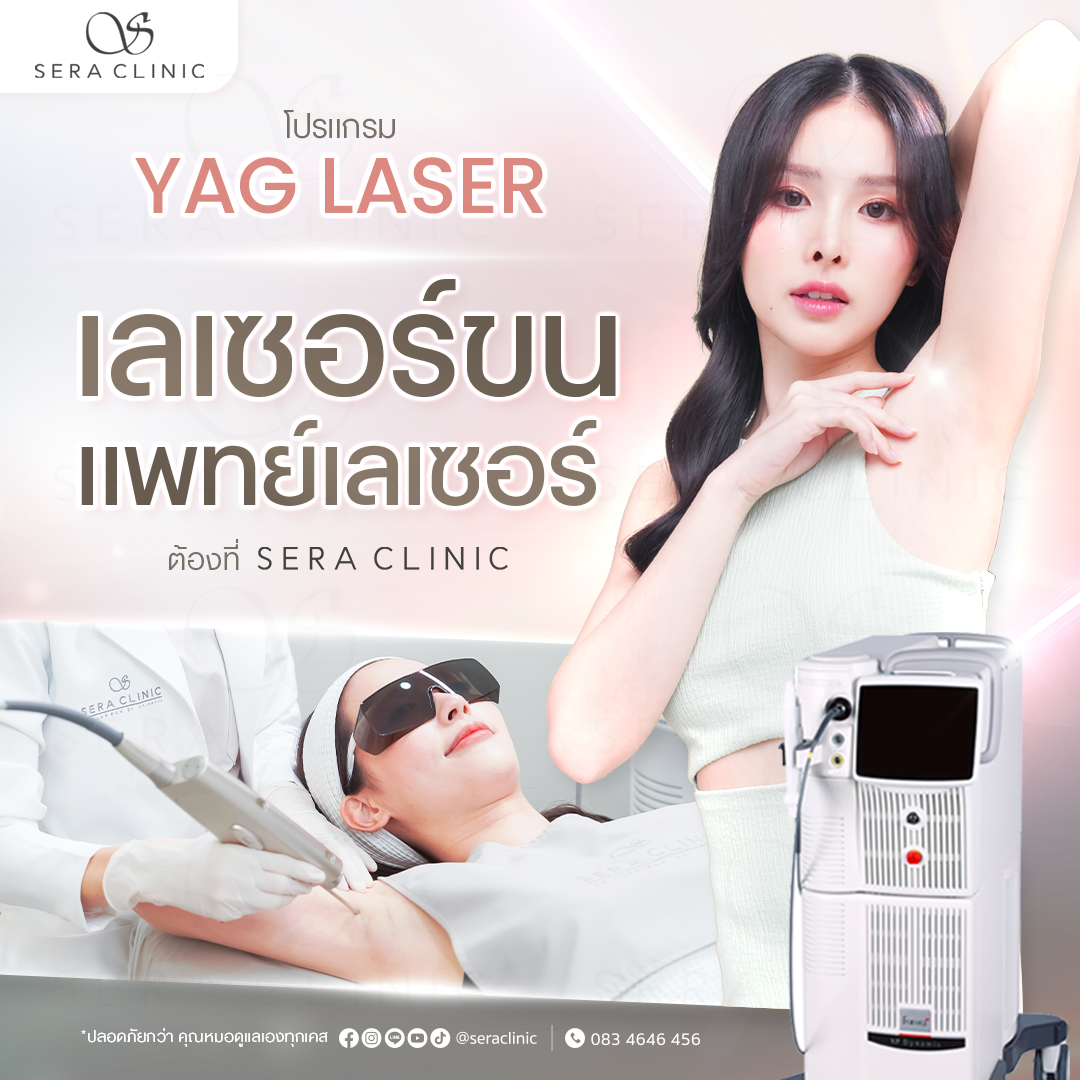 Yag Laser เลเซอร์ขน กำจัดขนรักแร้
