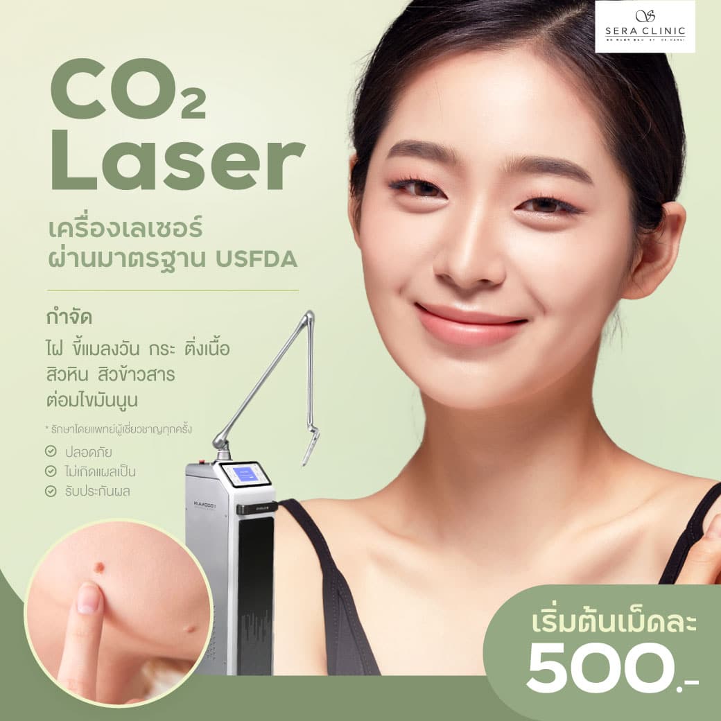 co2 laser กำจัดไฝ ขี้แมลงวัน