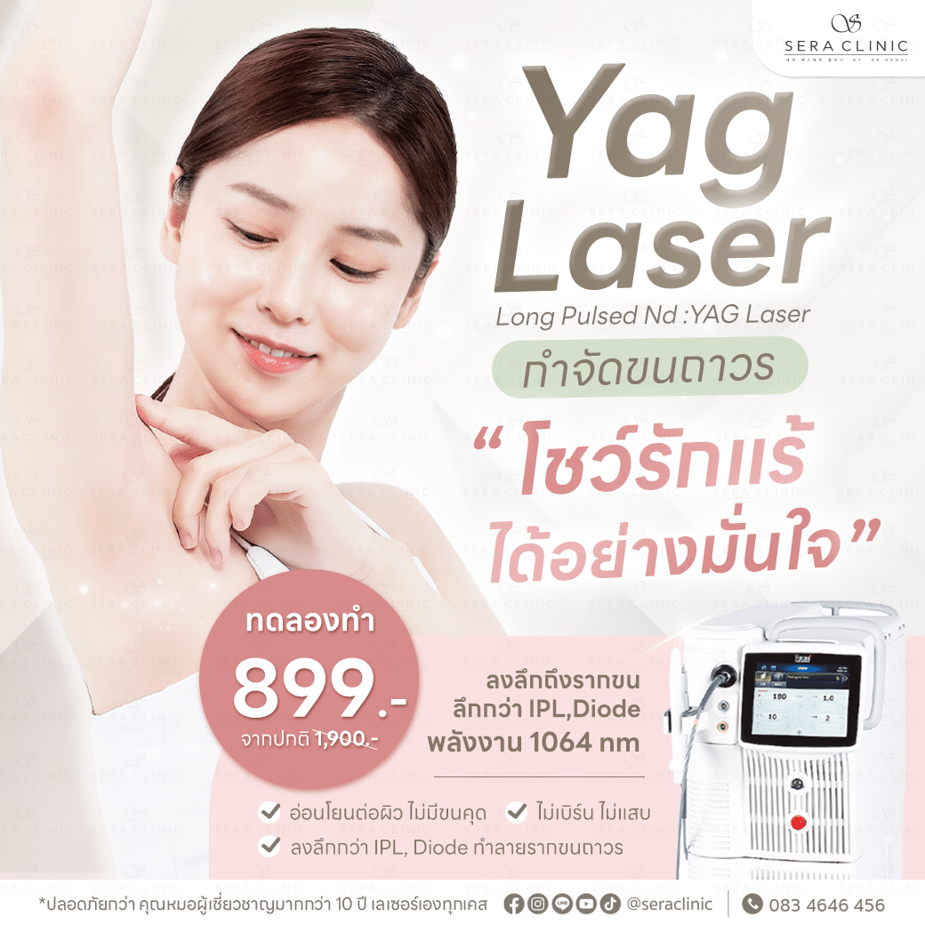 เลเซอร์ กำจัดขนถาวร เลเซอร์ขน ขนรักแร้ ขนบิกินี่ ขนบราซิเลี่ยน long pulsed nd yag laser เซราคลินิก sera clinic