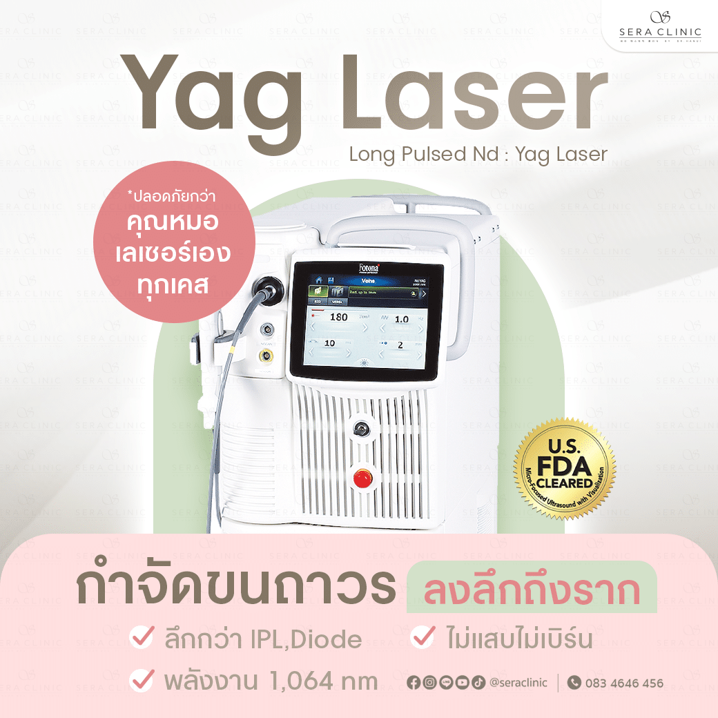 เลเซอร์ กำจัดขนถาวร เลเซอร์ขน ขนรักแร้ ขนบิกินี่ ขนบราซิเลี่ยน long pulsed nd yag laser เซราคลินิก sera clinic