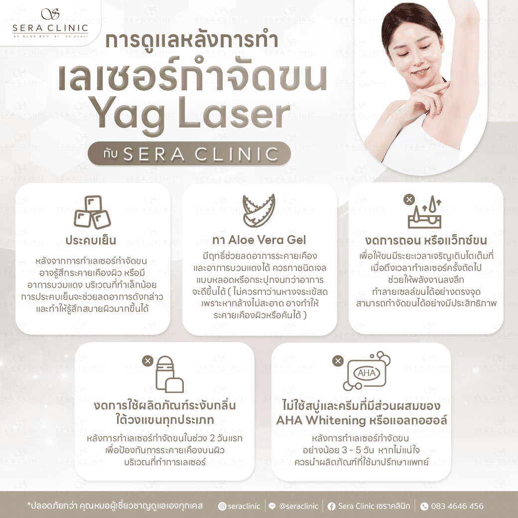 Yag Laser กำจัดขน