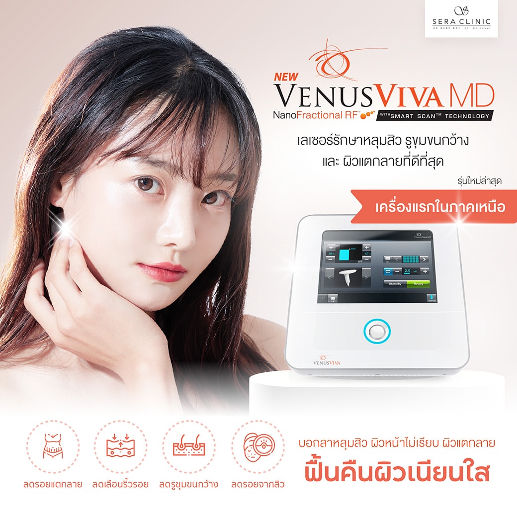 Venus Viva MD เลเซอร์รักษาหลุมสิว ผิวเรียบเนียนที่สุด