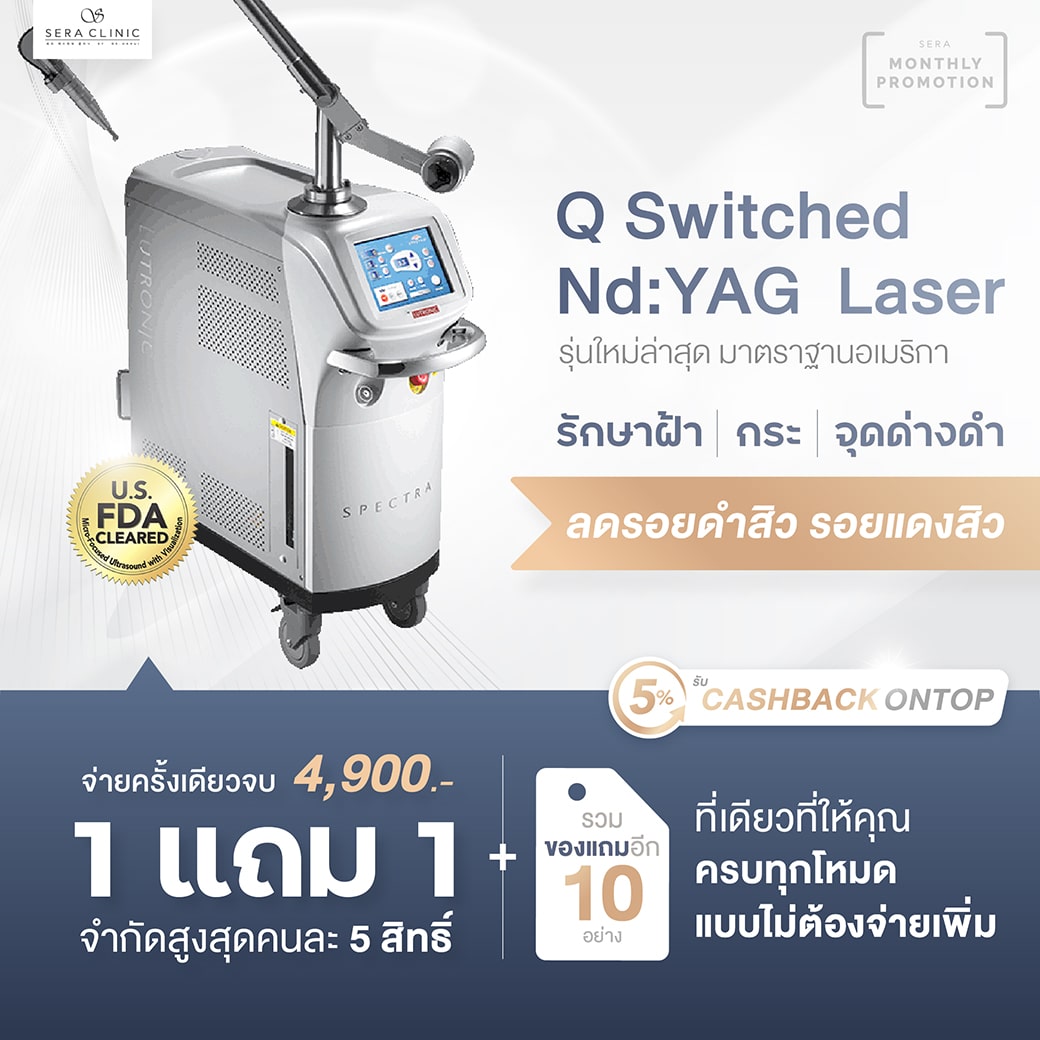 Q Switched Nd YAG laser Sera clinic