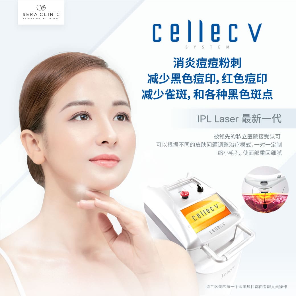 Cellec V IPL 让你的脸部重新焕发光彩 光子嫩肤的最新技术