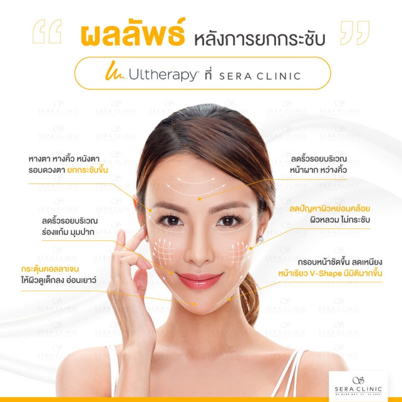 ultherapy SPT ยกกระชับผิว ลดริ้วรอย ปรับรูปหน้าเรียว ลดเหนียง