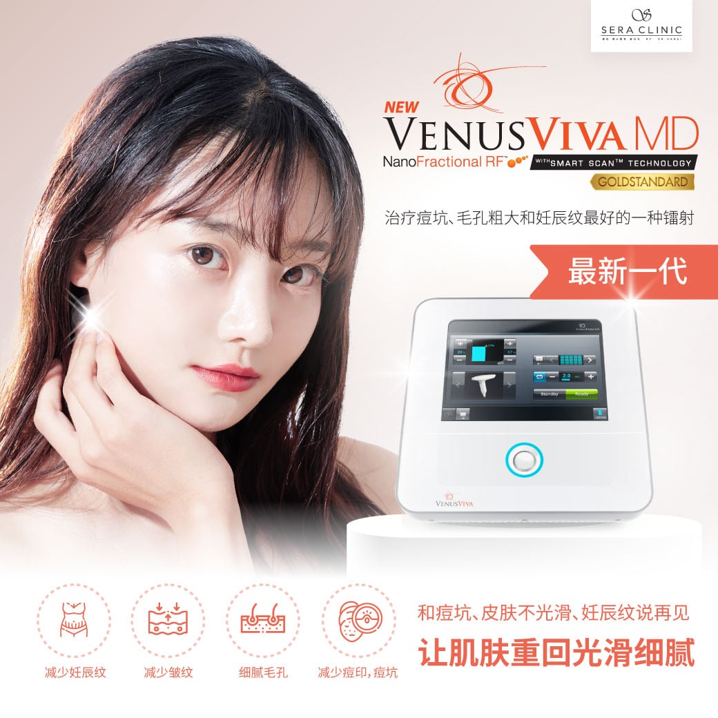 Venus Viva MD 激光痤疮疤痕治疗