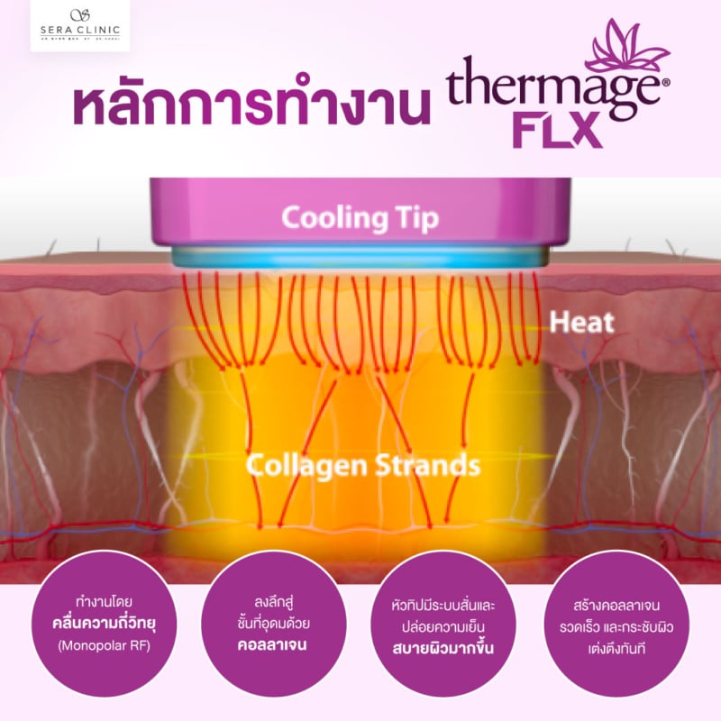 thermage flx เทอร์มาจ ยกกระชับผิว หน้าเรียว อ่อนเยาว์ กระตุ้นคอลลาเจน เซราคลินิก sera clinic