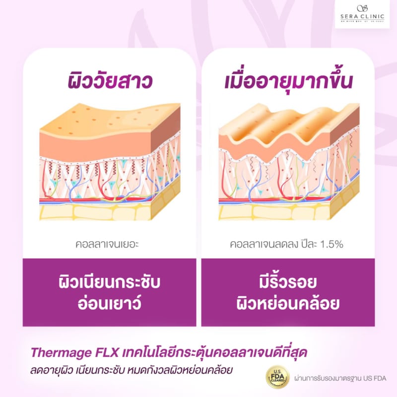 thermage flx เทอร์มาจ ยกกระชับผิว หน้าเรียว อ่อนเยาว์ กระตุ้นคอลลาเจน เซราคลินิก sera clinic