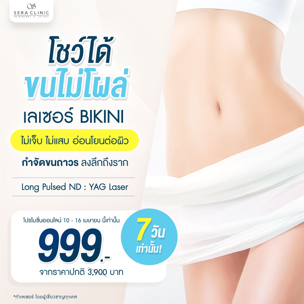 เลเซอร์-กำจัดขน-บิกินี่-bikini-บราซิเลี่ยน-brazilian-โปรโมชั่น-สงกรานต์-ซัมเมอร์-เมษายน-summer.jpg