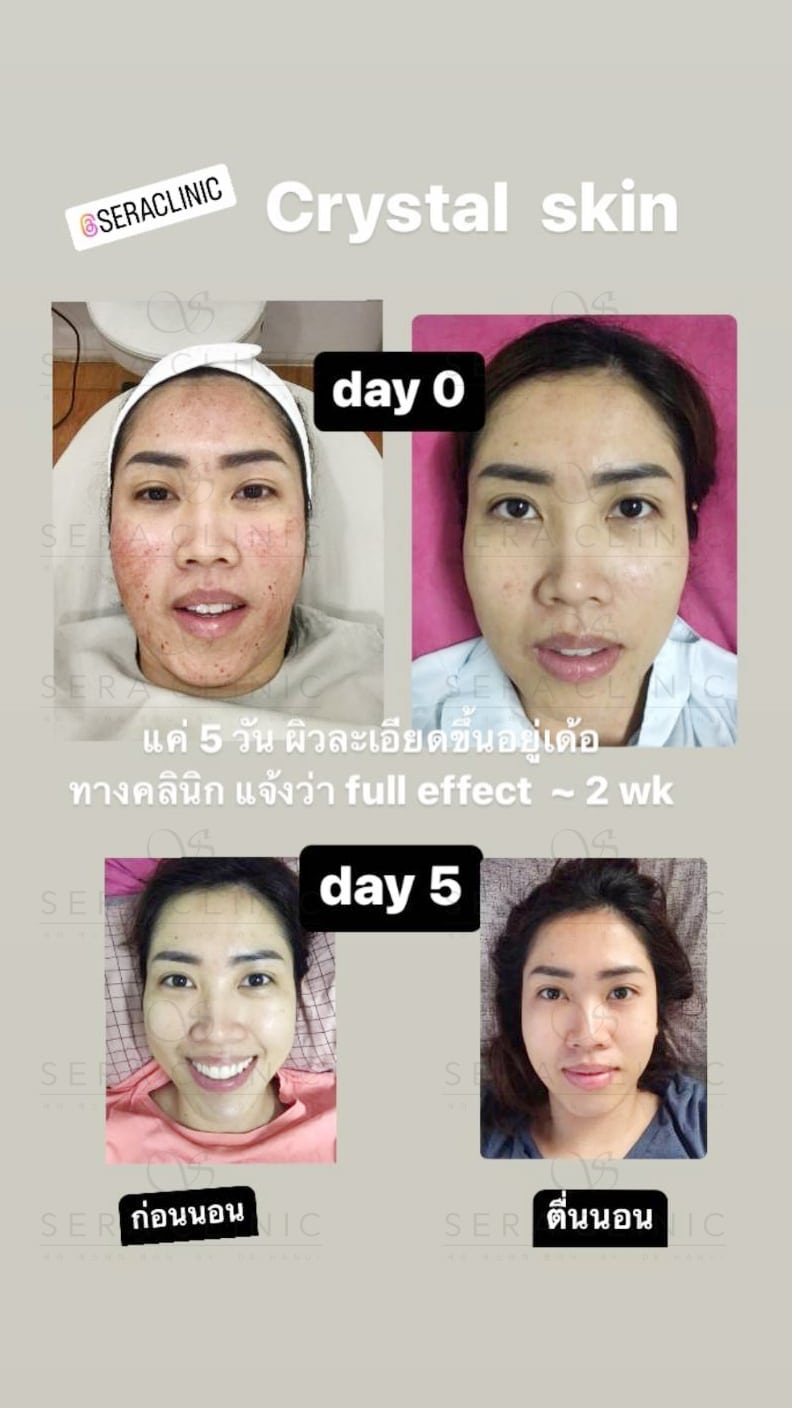 review รีวิว เซราคลินิก Sera Clinic Sera Crystal Skin นวัตกรรมเกาหลีขั้นสูง ฟื้นฟูผิวใส ลึกระดับเซลล์ หน้าฉ่ำวาว