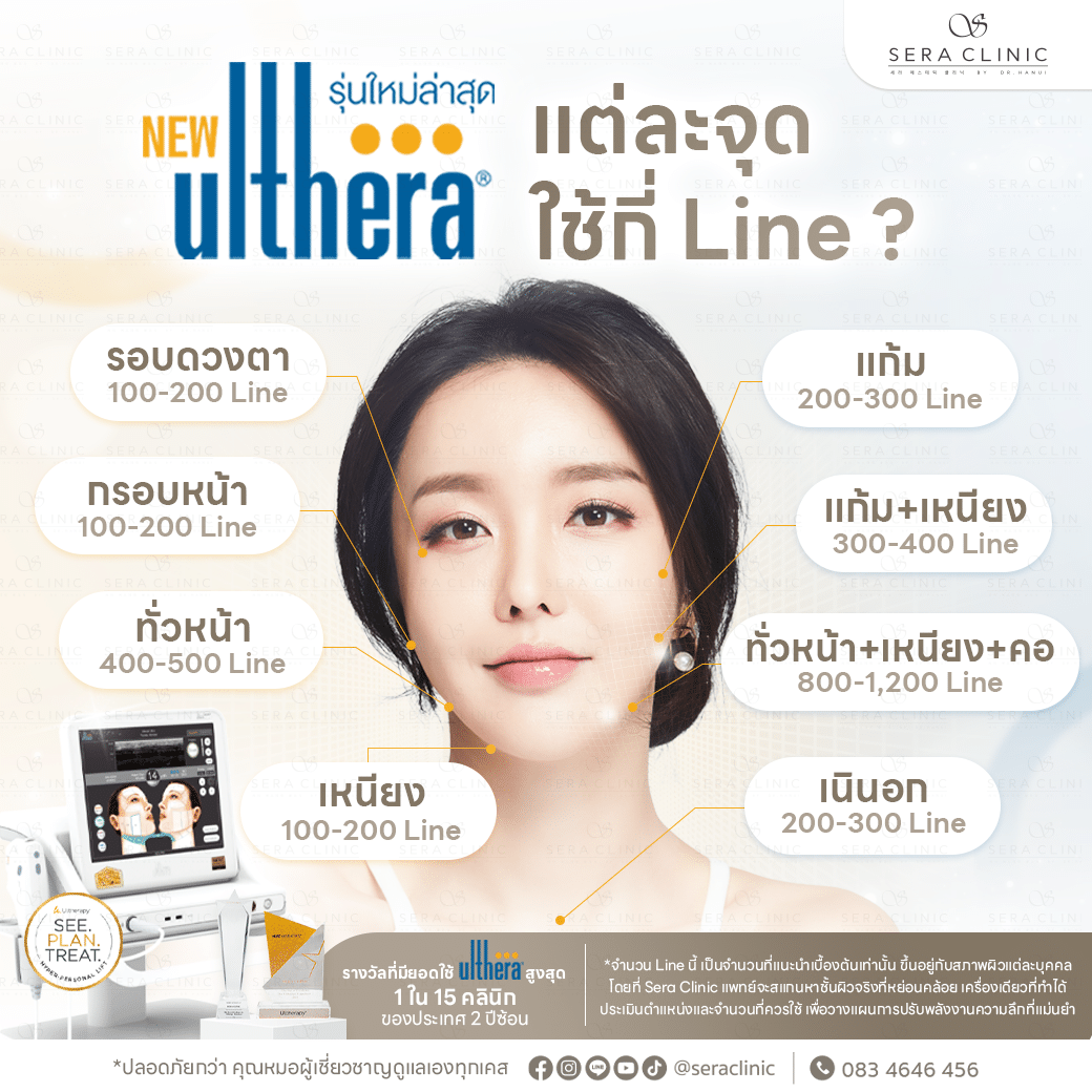 ultherapy SPT ยกกระชับผิว ลดริ้วรอย ปรับรูปหน้าเรียว ลดเหนียง sera clinic เซราคลินิก เครื่องแท้ รางวัลคลินิกที่มียอดใช้สูงสุดระดับประเทศ แต่ละจุด ทำกี่ line shot แต่ละส่วน