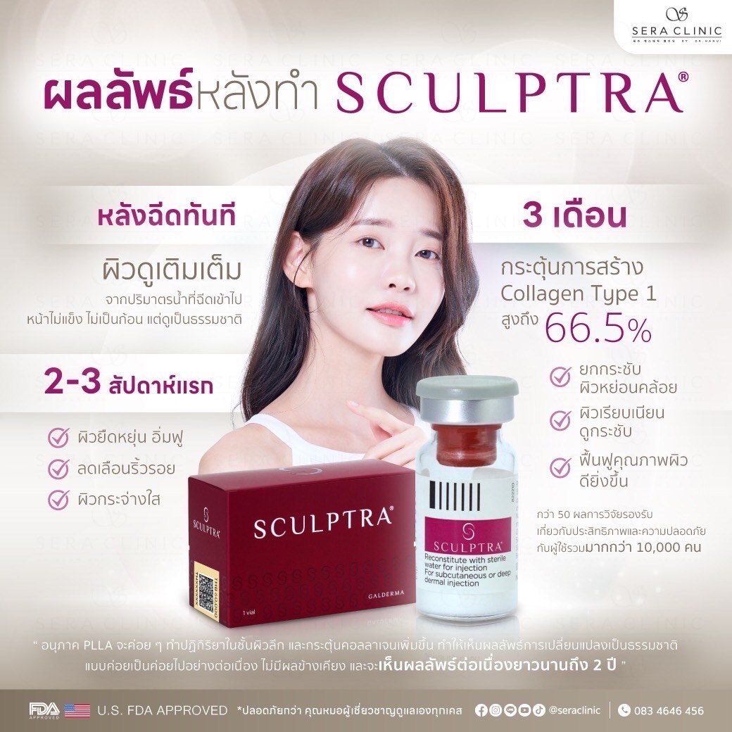 นวัตกรรมใหม่ที่รอคอย! Sculptra ฟื้นฟูผิวเด็ก นานถึง 2 ปี อ่อนเยาว์ กระตุ้นคอลลาเจน ลดริ้วรอย สคัลตร้า นานกว่าฟิลเลอร์ 25 เดือน หน้าเด็ก ยกกระชับผิว ผิวกระจ่างใส คอลลาเจน Type 1 collagen biostimulator Poly-L-Lactic Acid (PLLA) sera clinic เซราคลินิก ผลลัพธ์หลังทำ