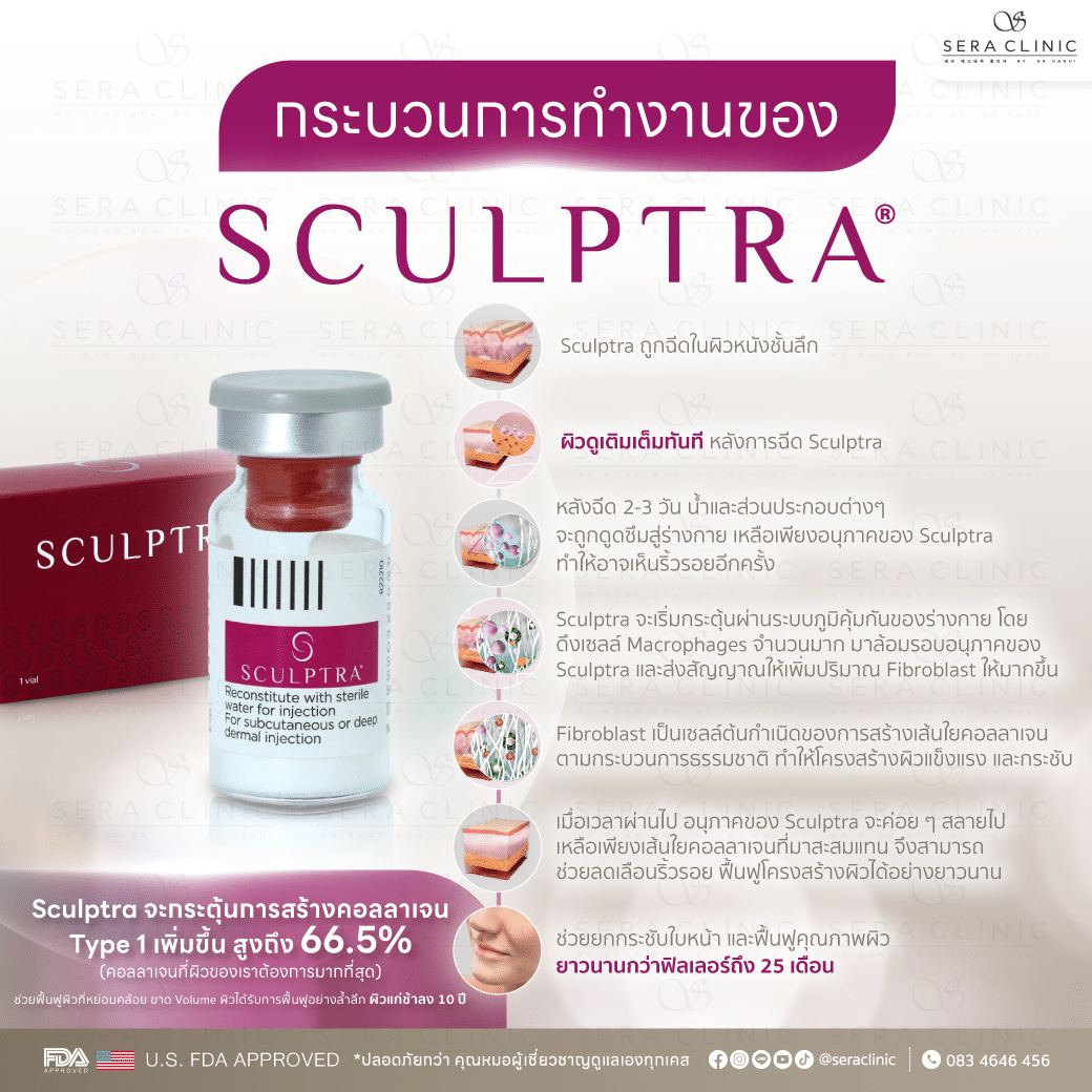 นวัตกรรมใหม่ที่รอคอย! Sculptra ฟื้นฟูผิวเด็ก นานถึง 2 ปี อ่อนเยาว์ กระตุ้นคอลลาเจน ลดริ้วรอย สคัลตร้า นานกว่าฟิลเลอร์ 25 เดือน หน้าเด็ก ยกกระชับผิว ผิวกระจ่างใส คอลลาเจน Type 1 collagen biostimulator Poly-L-Lactic Acid (PLLA) sera clinic เซราคลินิก กระบวนการทำงาน