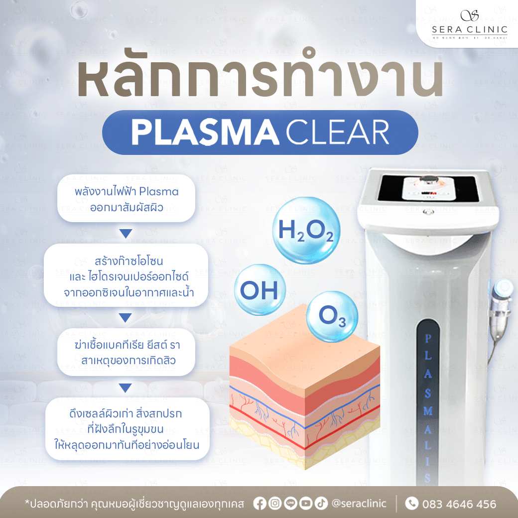 ผิวสะอาดล้ำลึก ลดสิวที่ต้นตอ plasma clear plasmalis พลาสม่า ทำความสะอาดผิว เทคโนโลยีผลัดเซลล์ผิวที่ลึกที่สุด ดึงสิ่งสกปรกในรูขุมขนออกมาทันที ฝุ่น มลภาวะเยอะแค่ไหนก็ไม่หวั่น เซราคลินิก sera clinic ลดสิวผด สิวอักเสบ สิวเสี้ยน สิวอุดตัน ผิวแพ้ง่าย เซ็บเดิร์ม หลักการทำงาน