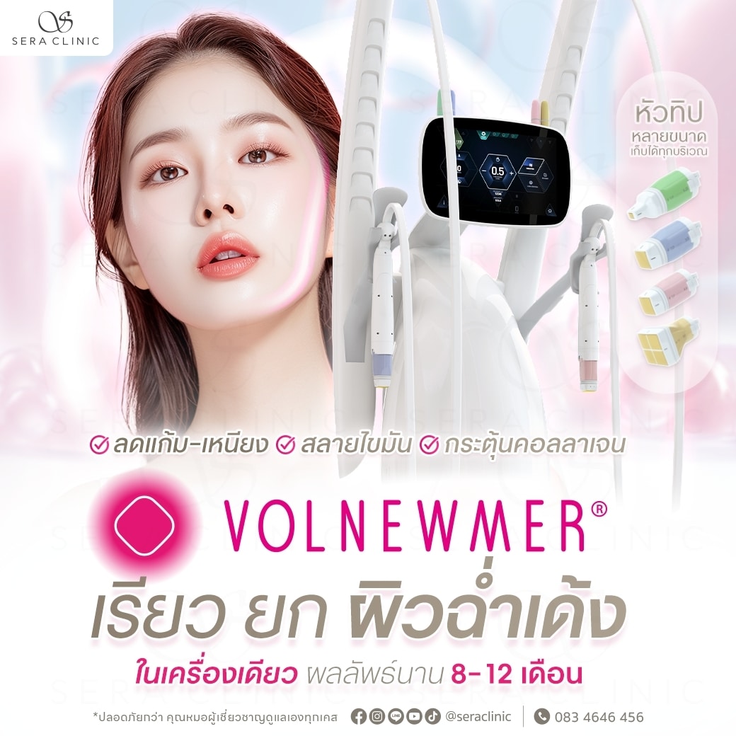 Volnewmer ยกกระชับผิว รีดแฟต กระตุ้นคอลลาเจน ผิวอิ่มฟู