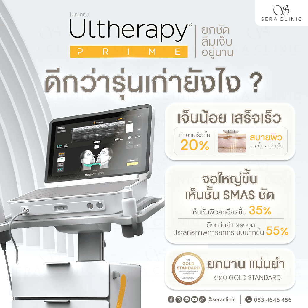 ultherapy prime