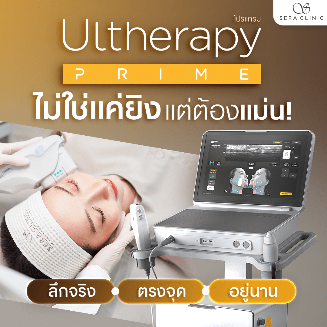 Ultherapy Prime ที่เชียงใหม่ เป็นยังไง ดีไหม น่ากลัวไหม ราคาแรงไหม?