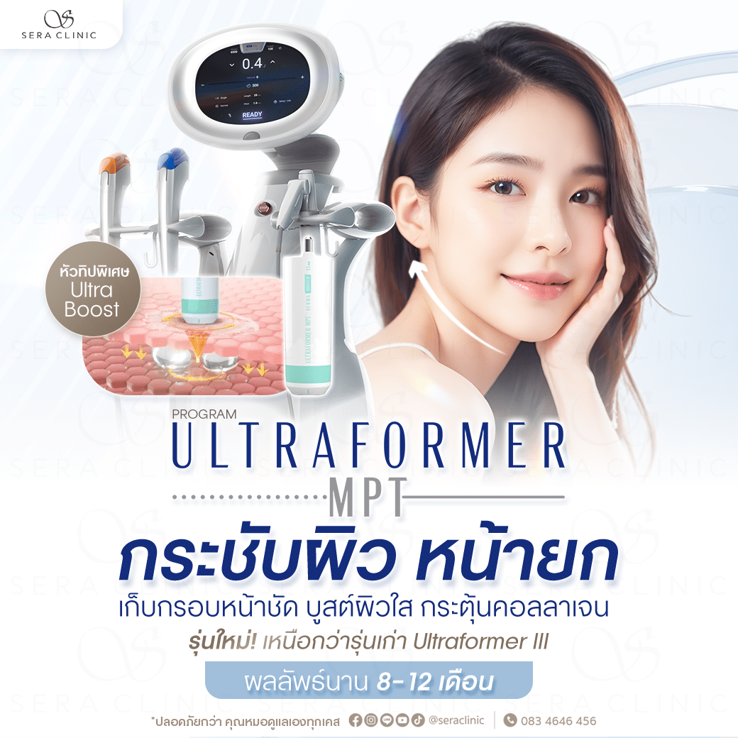Ultraformer เชียงใหม่ | Ultraformer MPT ยกกระชับผิว ที่ Sera Clinic