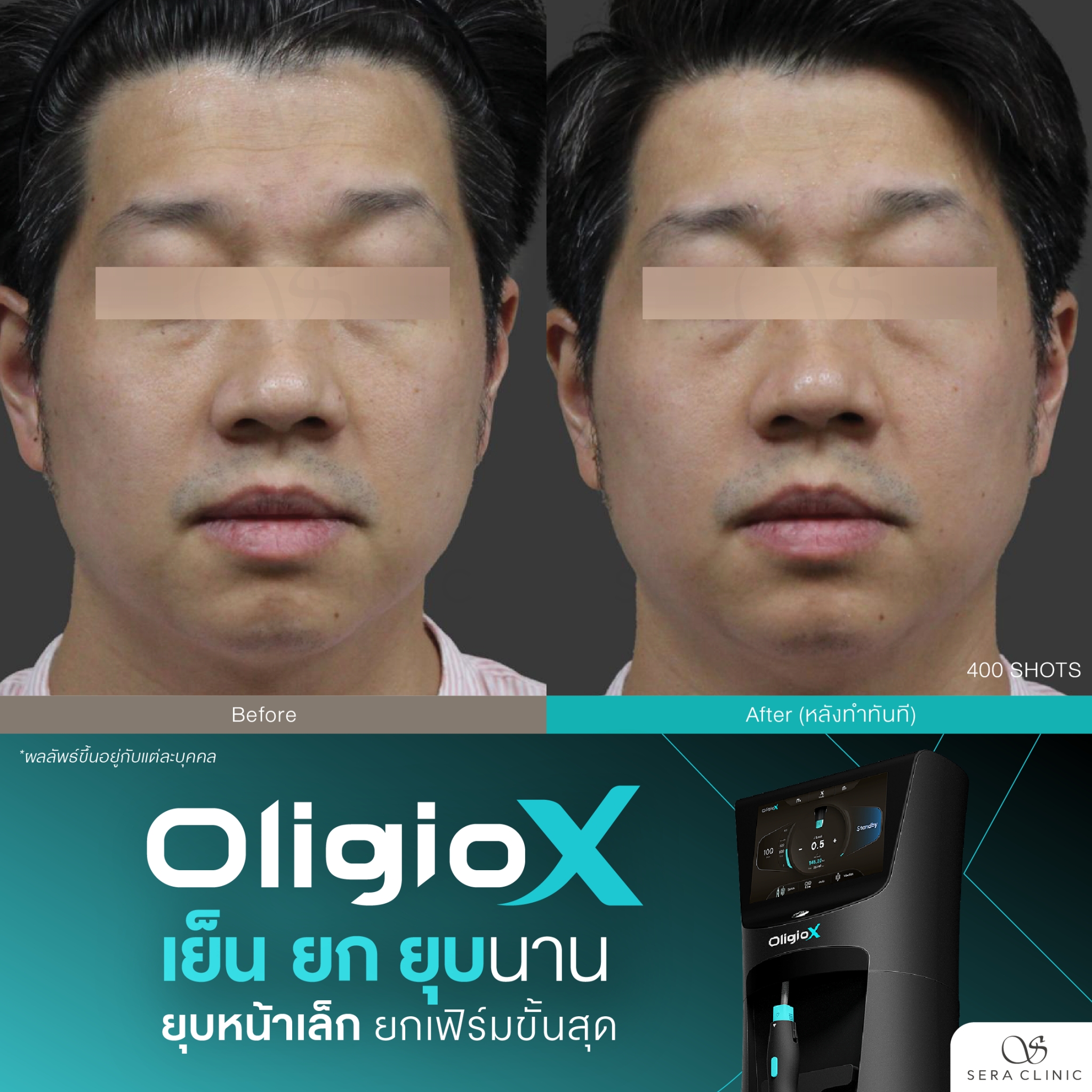 LINE_ALBUM_REVIEW_OLIGIOX_260407_8