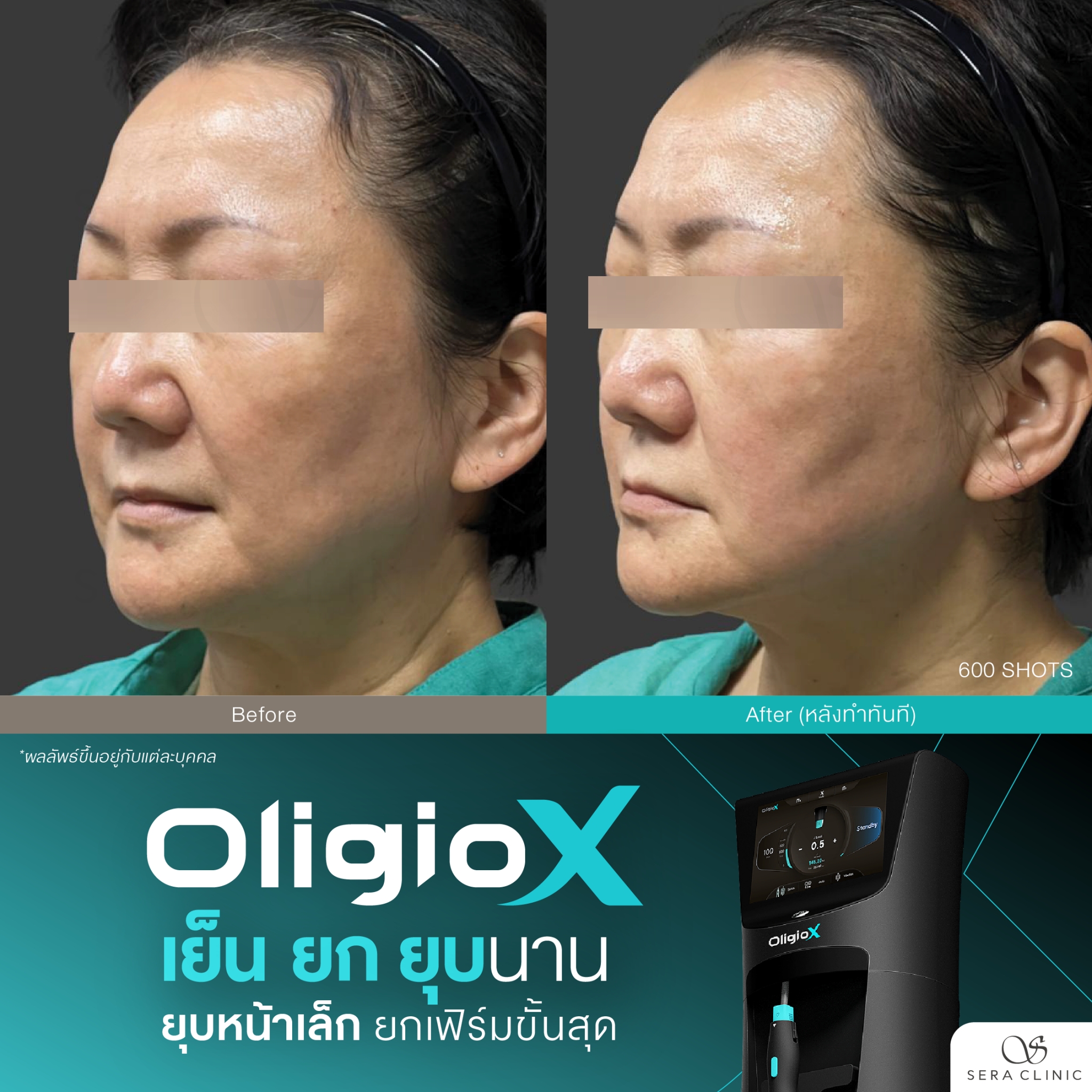 LINE_ALBUM_REVIEW_OLIGIOX_260407_9