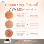 Check ! หลุมสิวแบบนี้ venus viva md Check ! หลุมสิวแบบนี้