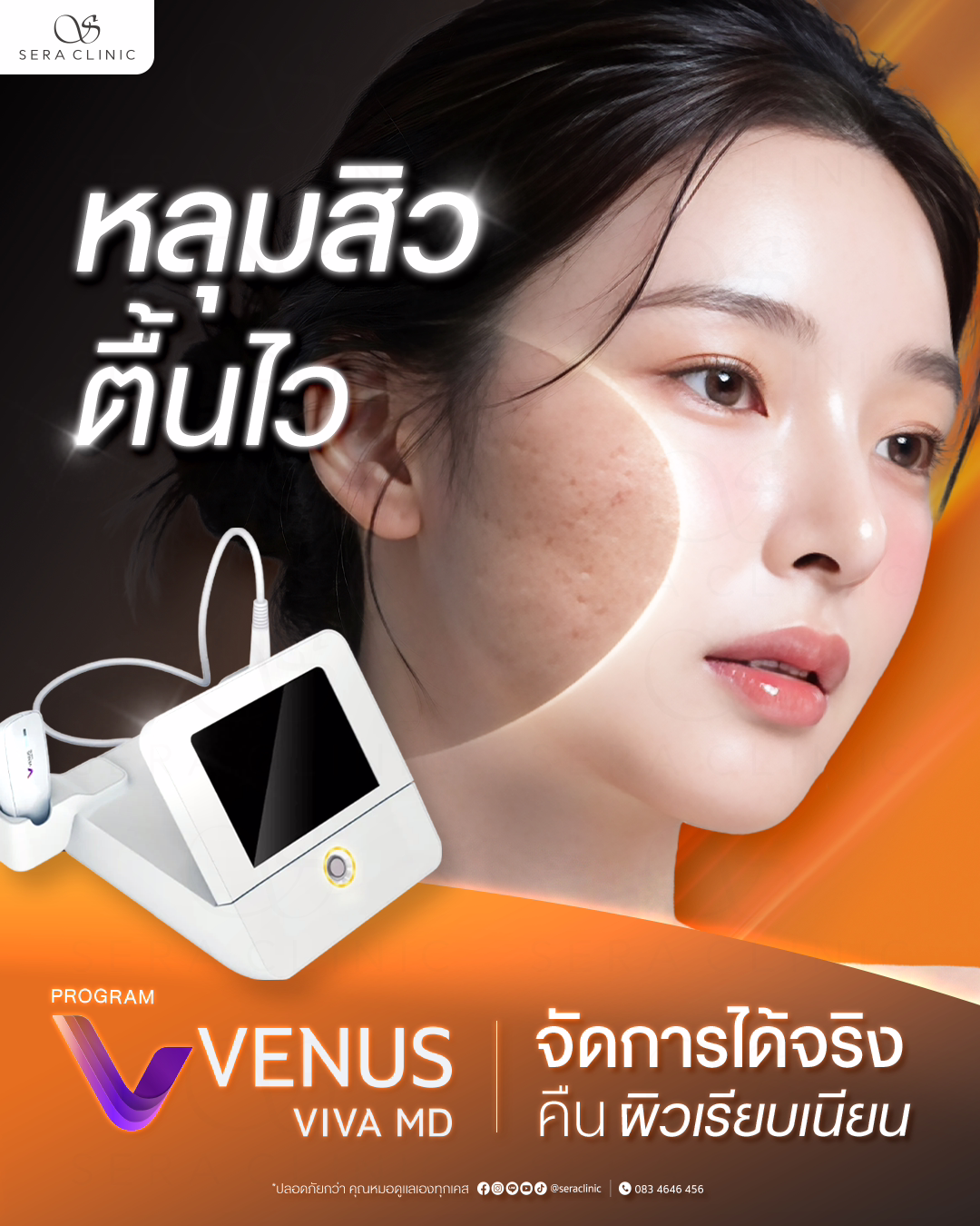 venus viva md venus viva md